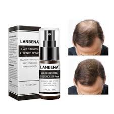 It won't rescue a receding hairline. Kupi Lanbena Fast Powerful Hair Growth Products Hair Spray Essence Anti Hair Fall Treatment Laser Hair Regrowth Za Zheni I Mzhe Naj Dobrite Boutique Shop Today