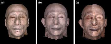 Reconstruction of 3D scanned images of a cadaveric face using MDS 3.0....