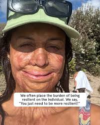 Turia Pitt