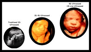 Know your baby from the start. 3d 4d Ultrasound San Diego California A Baby Visit