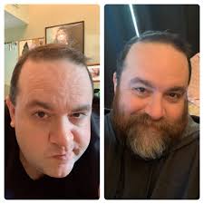 Bearded Joe>>>>>clean-shaven Joe