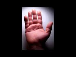 This disorder occurs when you have an extra copy of chromosome 21. Simian Crease Single Transverse Palmar Crease Down Syndrome Youtube