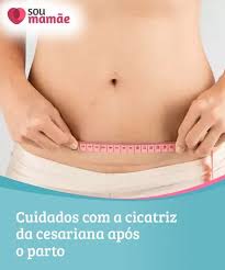 Cuidados Com A Cicatriz Da Cesariana Apos O Parto Os Cuidados Com A Cicatriz Da Cesariana Sao Simples Mas De Cesariana Recuperacao Cesariana Cinta Pos Parto