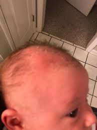 That makes it seem thicker and more luscious. Did I Just Make My Baby S Hair Fall Out June 2019 Babies Forums What To Expect
