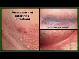 Pin On Diy Health Beauty More