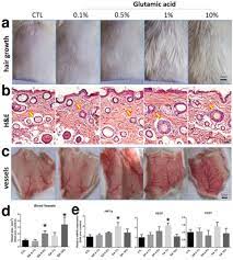 Hair growth is affected by topical application of a boron containing compounds/complexes in which a central tetrahedral atom is covalently bound to four ligands. Glutamic Acid Promotes Hair Growth In Mice Biorxiv
