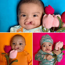 Free to Smile Foundation