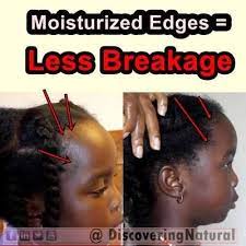 Aug 10, 2021 · while children's hairstyles were once as simple and easy as gelling hair and combing it to the side, modern kids haircut styles have become just as. African Naturalistas Traction Alopecia In Children S Hair Traction Alopecia Alopecia In Children Hair Nutrients