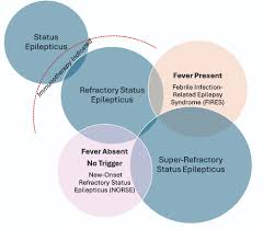 Image result for Status Epilepticus