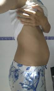 See full list on guiainfantil.com La Barriga 7 Meses Despues De Un Embarazo Gemelar Mama Valiente