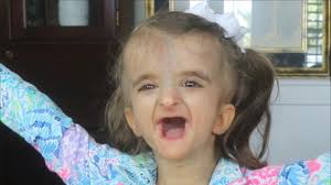 Gabby's Great Adventure (Life with a Rare Genetic Condition)