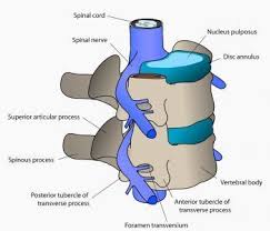 Vertebrae Spine Surgery Degenerative Disc Disease Neck Traction