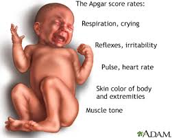 Image result for delivery baby