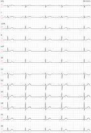 Ecg Test Library Quiz 1 Ecg Echo