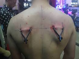 Piercings are no longer simply for the ears and tattoos seem to. Newcastle Man Has Spider Magnet Octopus Rings Implanted Under His Skin Photos Newcastle Herald Newcastle Nsw