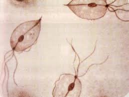 Image result for trichomonas images