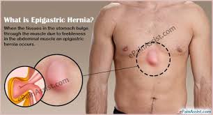 Pin On Learning About Health And Health Conditions