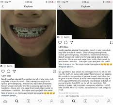 Check spelling or type a new query. Gara Gara Pakai Braces Rm580 Gigi Jadi Mangsa Seramnya Kisah Dunia