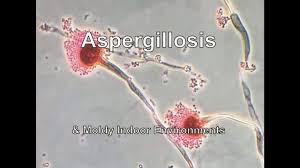 One kind is allergic bronchopulmonary aspergillosis (also called abpa), a condition where the fungus causes allergic respiratory symptoms similar to asthma, such as wheezing and coughing, but does not actually invade and destroy tissue. Aspergillosis Moldy Indoor Environments Youtube