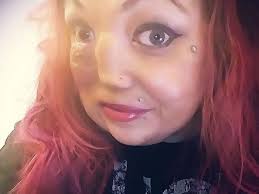 Fundraiser by Stephanie Kwasny : Vascular Tumor Surgery fund for Stephanie