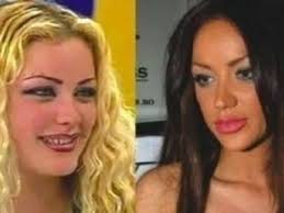 E frumos, a răspuns andreea bălan despre nasul său. Cum Arata Vedetele Autohtone Inainte Si Dupa Operatiile Estetice Ele Ro