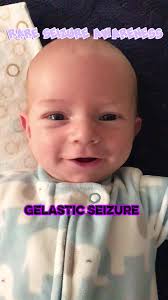 What Does It Mean If A Baby Keeps Looking over Their Head and Laughing