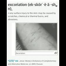 Excoriation Medical Term Medical Terms Alternative Medicine Vocab