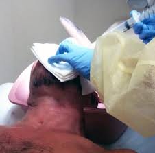 Image result for Eye Irrigation