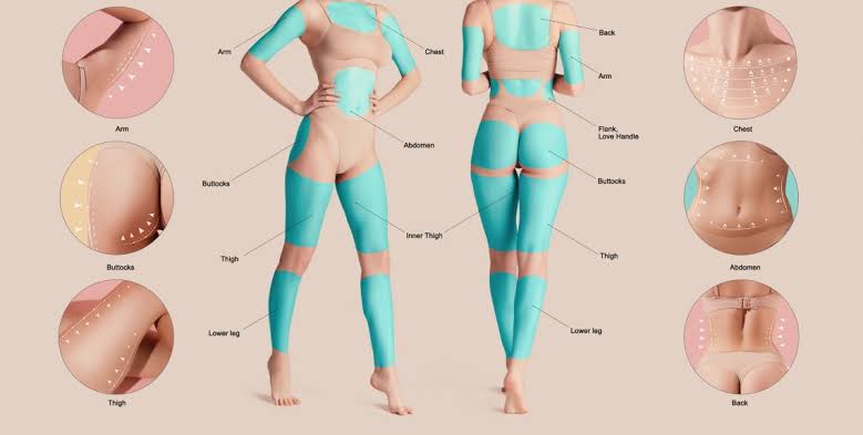 Common Target Areas for Liposuction Body Contouring, AI generated