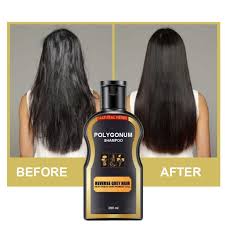 Which helps to maintain color strength and depth, enhancing the vibrancy and freshness of your hair color. Hair Shampoo Permanent Black Color Anti Gray Hair Treatment White Removal Natural Herbal Black Hair Shampoo Grey Reverse 30ml Organic Hair Care Products Good Hair Care Products From Qq653904566 14 56 Dhgate Com