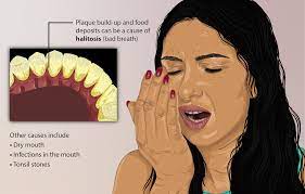 Bad Breath - Wikipedia