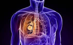 .about health tips, good and bad healthy habits, diseases, symptoms, how to diagnose diseases, what are the symptoms, what are the general cancer are 1. Quarter Of Cancer Patients Losing Faith In Nhs Because Of Late Diagnosis