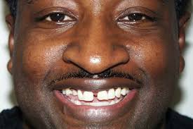 Cosmetic Dentistry in Virginia Beach, VA