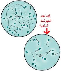 Assessment | biopsychology | comparative | cognitive | developmental | language | individual differences | personality | philosophy | social | methods | statistics | clinical | educational | industrial | professional items | world psychology |. Ø§Ù„Ø·Ù€Ù€Ø¨ Ø¨Ø­Ù€Ø±ÙˆÙ Ø¹Ø±Ø¨ÙŠÙ€Ù‡ Ù‚Ù„Ù‡ Ø¹Ø¯Ø¯ Ø§Ù„Ø­ÙŠÙˆØ§Ù†Ø§Øª Ø§Ù„Ù…Ù†ÙˆÙŠÙ‡ Ø§Ù„Ø§Ø³Ø¨Ø§Ø¨ ÙˆØ§Ù„Ø¹Ù„Ø§Ø¬ Ø§Ù„Ø¬Ø²Ø¡ Ø§Ù„Ø§ÙˆÙ„