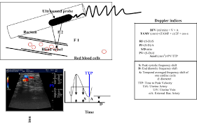 manipulation and orientation of doppler ultrasound probe and