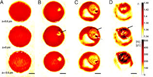 Maybe you would like to learn more about one of these? Refractive Index Maps And Membrane Dynamics Of Human Red Blood Cells Parasitized By Plasmodium Falciparum Pnas