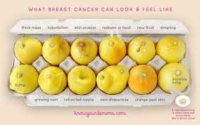 The answer to the question is pretty simple when you learn the abcde (asymmetry, borders, color, diameter, and evolving) rules! This Viral Photo Literally Describes All Of The Symptoms Of Breast Cancer