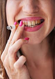 J Ai Des Dents Jaunes Que Puis Je Faire Sanz Clinica Dental