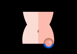 Knoten im unteren linken Bauch | Ursachen für einen Knoten im linken Magen
