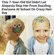 This 7-Year-Old ear- Girl Didn't Let Alopecia Stop Her From Dazzling  Everyone At School On Crazy Hair Day