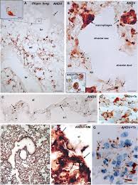 Hantaviruses are transmitted to humans from the dried droppings, urine, or saliva of mice and rats. Frontiers Immunocytochemical And Ultrastructural Evidence Supporting That Andes Hantavirus Andv Is Transmitted Person To Person Through The Respiratory And Or Salivary Pathways Microbiology