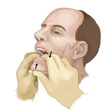 Image result for Jaw Dislocation