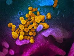 Swap enters a system when a disk infected with the virus is booted. Colour Change New Corona Test Could Give Results In Just 30 Minutes The Economic Times