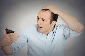Abnormal Hair Loss Health Navigator Nz