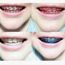 Warna getah braces tags : Ready Stock Malaysia Online Shop Shopee Malaysia
