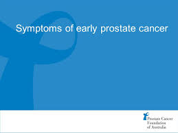 Prostate cancer is the second most common cancer diagnosed in men in australia and the third most common cause of cancer death. Prostate Cancer Foundation Of Australia Ambassador Presentation Prostate Health Ppt Download