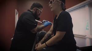Because tattoo removal depends on the body to flush away the shattered ink particles, areas of the body with less circulation often take more time to show results. Worcester Tattoo Removal