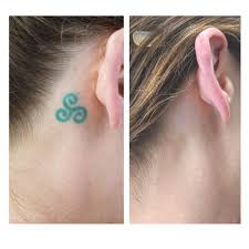 There is good news for those who have an unwanted body desig. Tattoo Removal 207 Laser Advanced Laser Practice