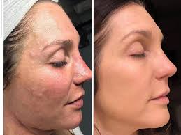 skindeepskincarestudio