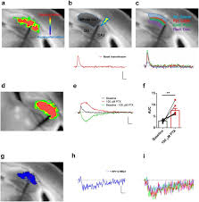 Pt stgi pier email / 2. Layer Specific Potentiation Of Network Gabaergic Inhibition In The Ca1 Area Of The Hippocampus Scientific Reports